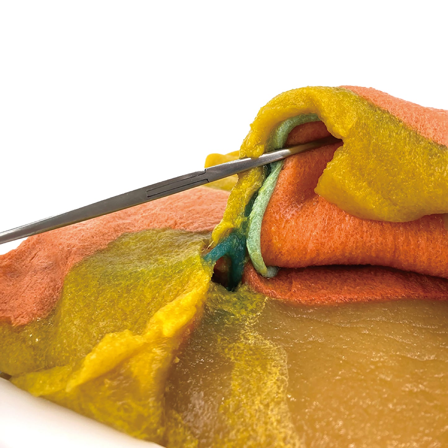 VTT Laparoscopic Distal Gastrectomy Model【VTT-LDG】
