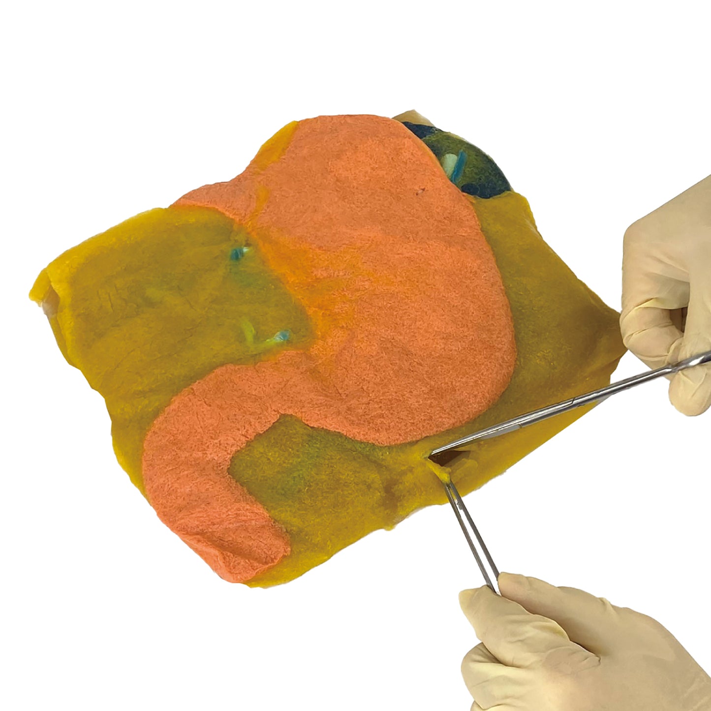 VTT Laparoscopic Distal Gastrectomy Model【VTT-LDG】