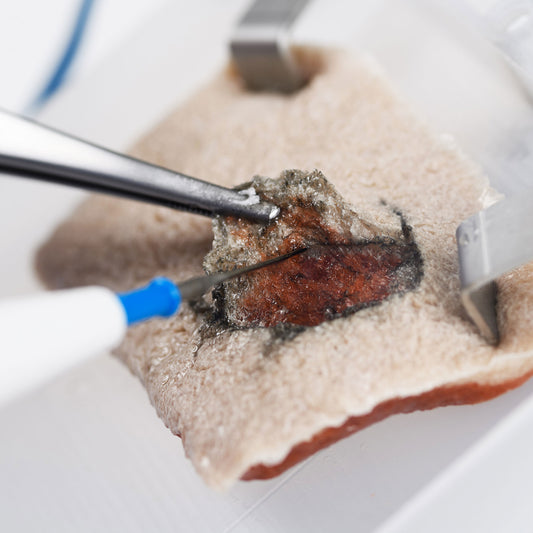 An incision is made on the Double Layer Type with an electrocautery pencil and forceps. The white muscular layer is pulled back to reveal soft red tissue slightly scorched by the thermal spread.