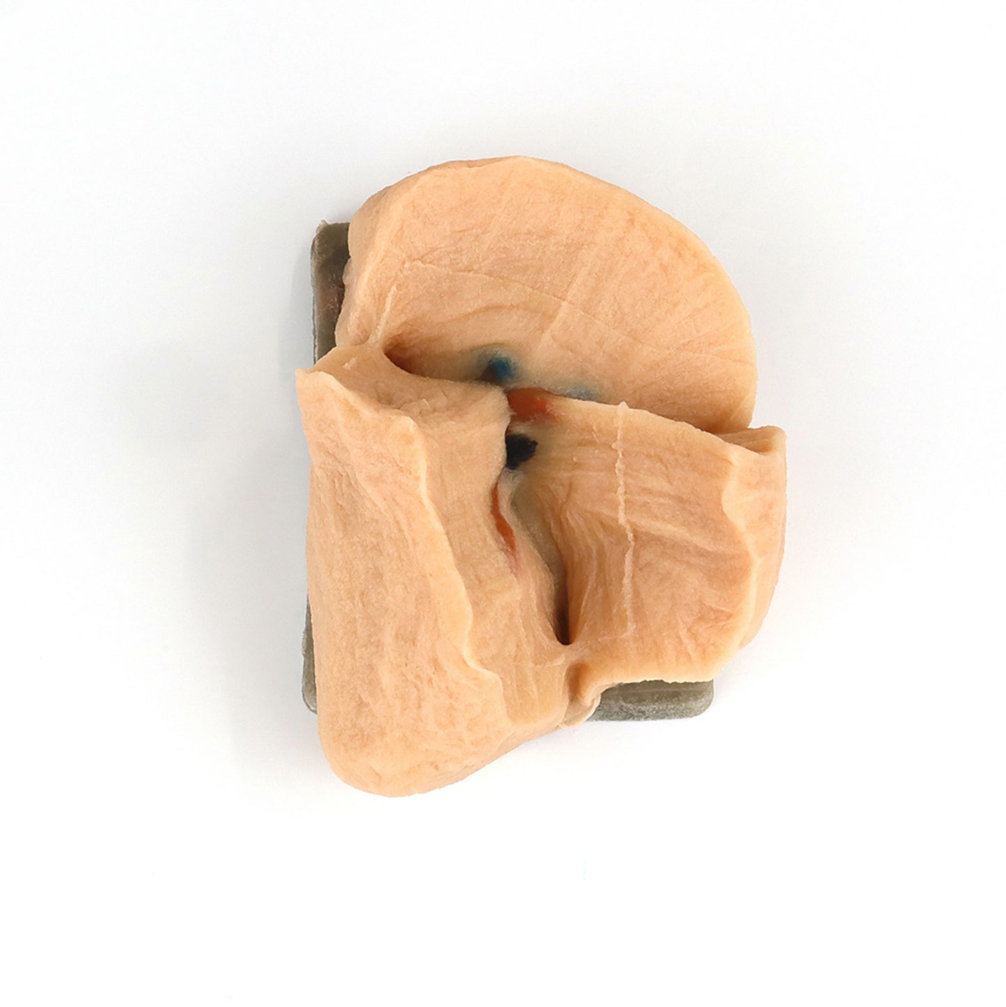 Right Lobectomy Model against a white background with the right upper lobe, the right middle lobe, and the right lower lobe all visible. Vessels and lymph nodes are also visible.