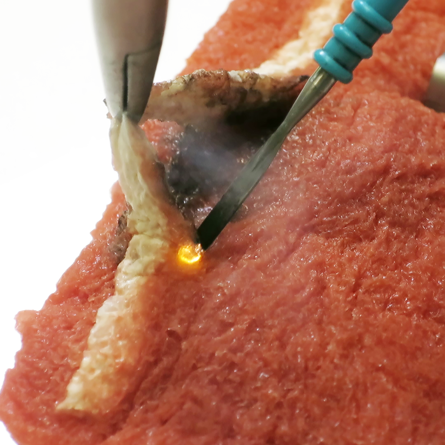 An electrocautery pencil separates the white synthetic vessel from softer tissue below. Despite the spark of heat, minimal smoke is created.
