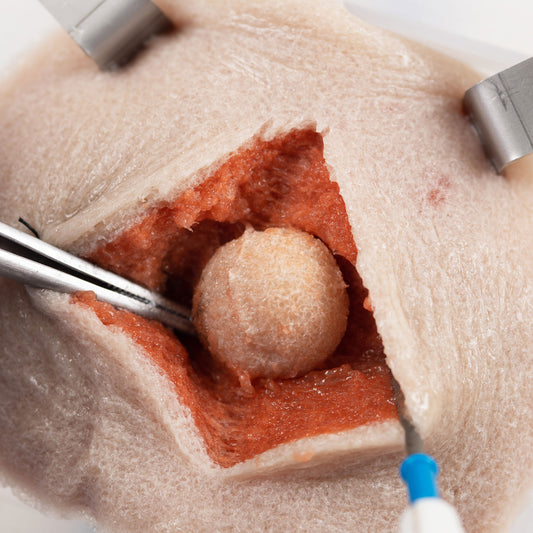 An incision in the Composite Tumor Model is opened to reveal the synthetic tumor inside.