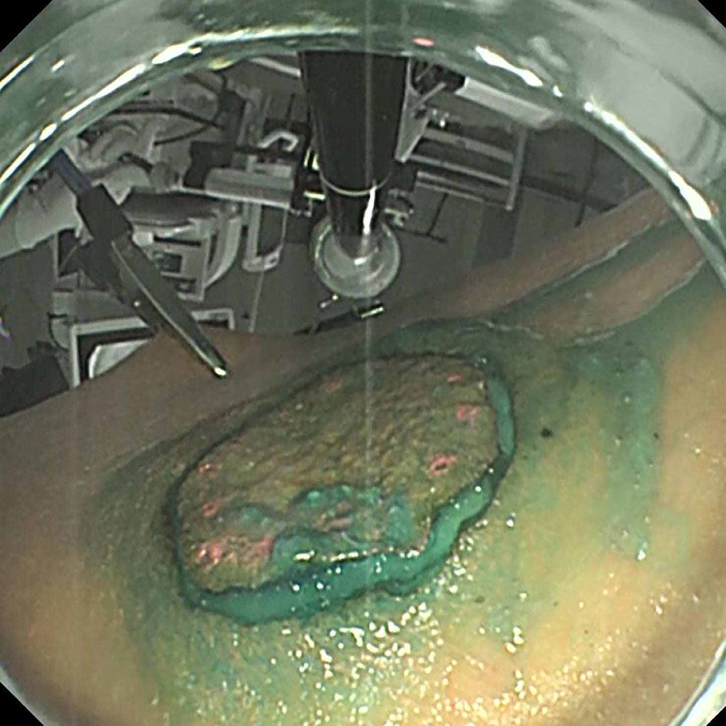 Endoscopic viewpoint of the circular incision made on the simulated gastric mucosal lining.