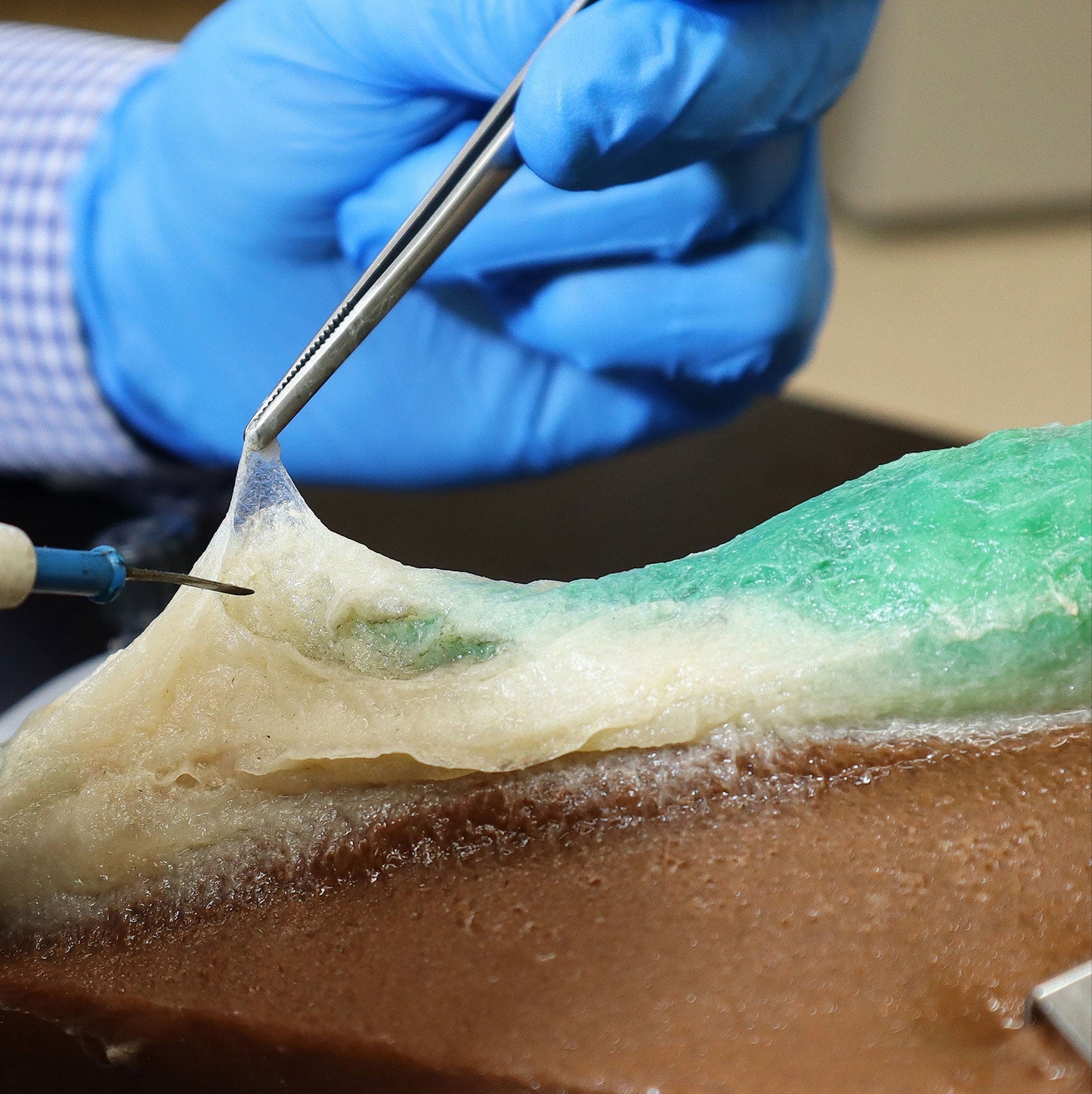 Demonstrator wearing blue gloves uses blunt dissection and to remove fascia from a plant-based synthetic gallbladder.