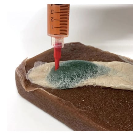 Cholecystectomy Model