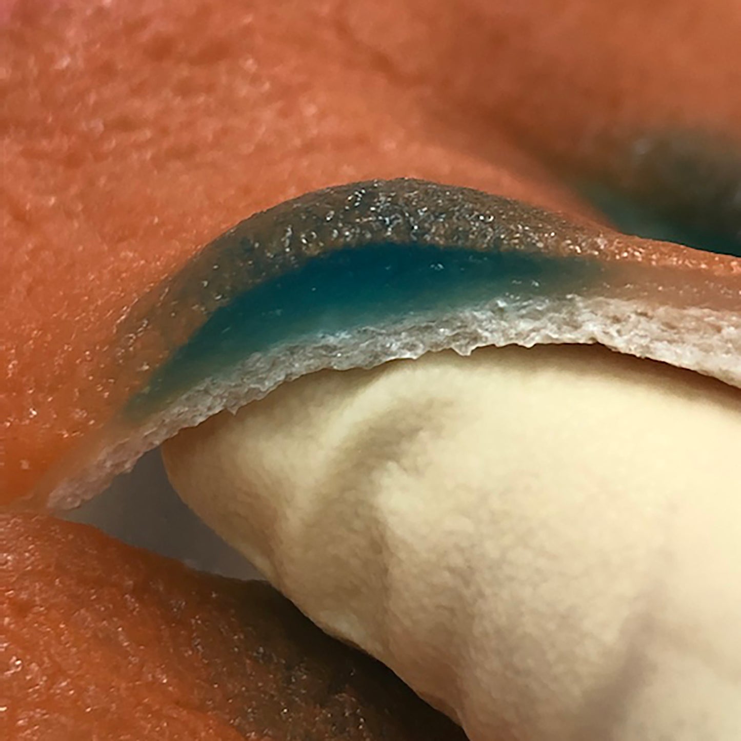 A gloved finger lifts a dissected section of the standard Mucosa Model. The VTT Injection Solution can be seen as a gel pocket injected into the submucosal layer. 