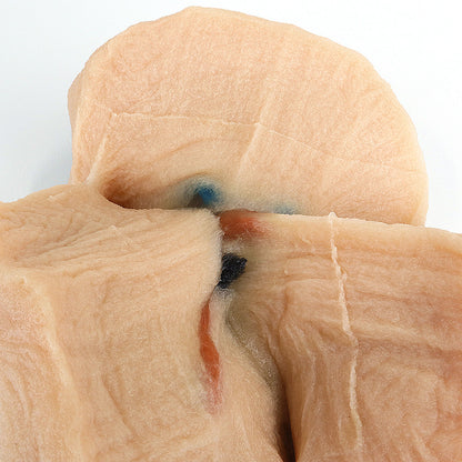 Closeup of the Right Lobectomy Model's horizontal fissure, through which a bronchus and some lymph nodes can be seen.
